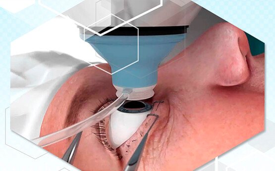 especialidade-clinica-de-olhos-cidade-nov-2020-8