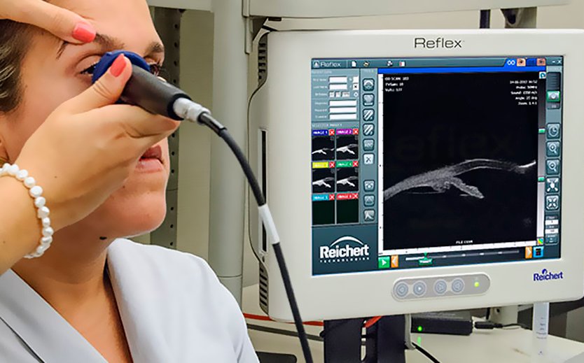 ultrassonografia-ocular2