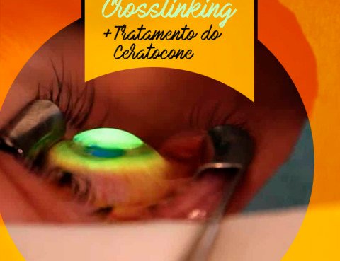 post-clinica-de-olhos-cidade-julho-2020