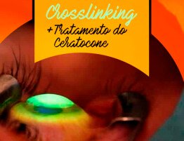 especialidade-clinica-de-olhos-cidade-nov-2020