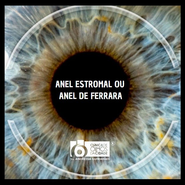 Anel Estromal